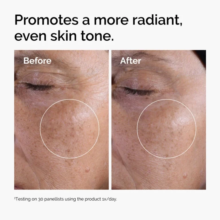 toner-2